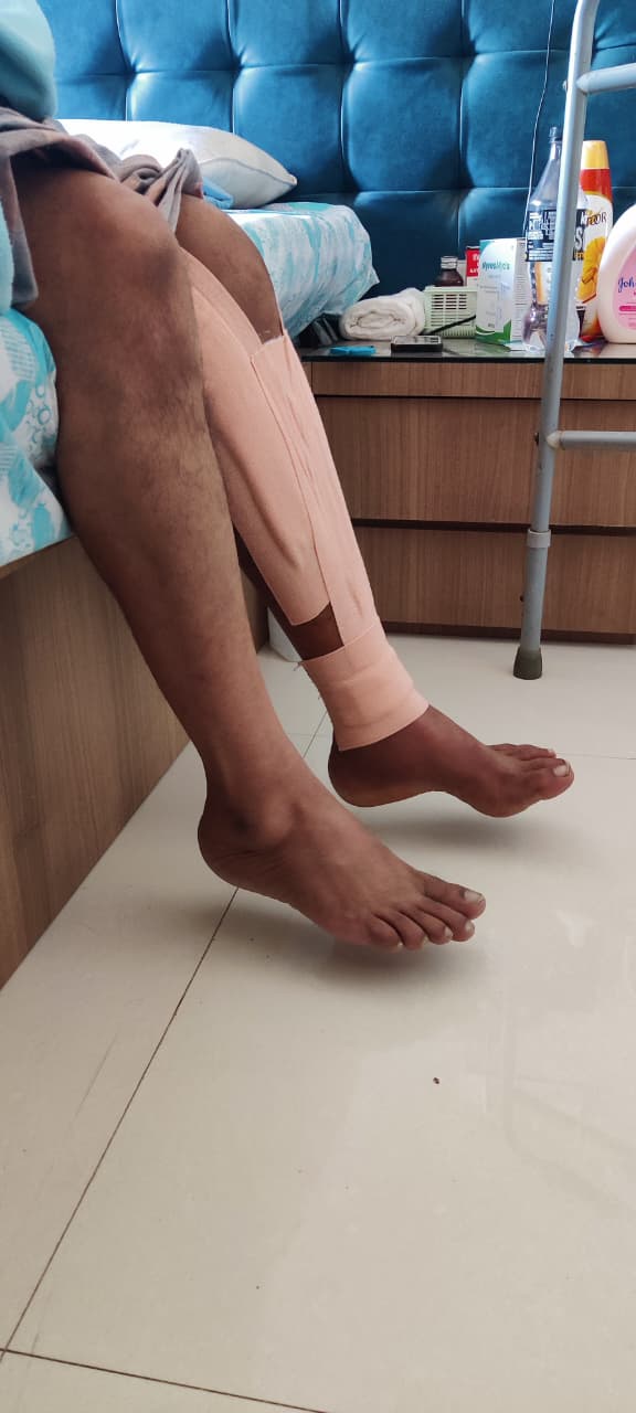 Knee Support Therapy